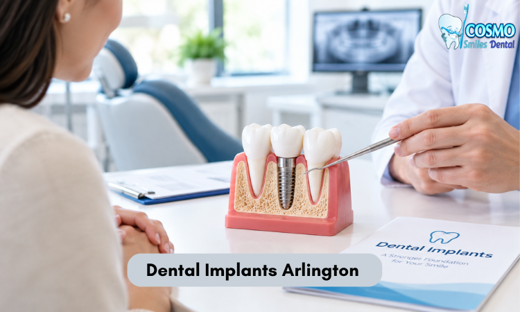 Dental Implants Arlington