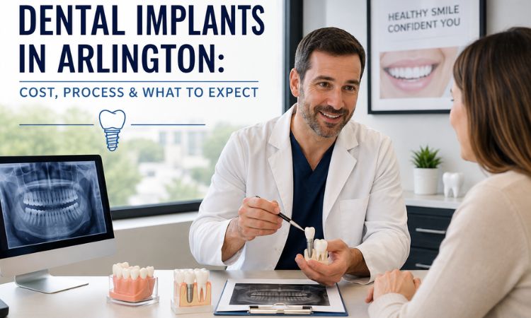 Dental Implants in Arlington